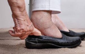 Tips to Prevent Water Retention