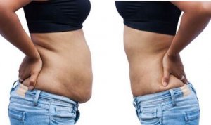 An Overview of Weight Loss Supplements