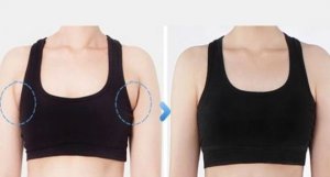 Arms before and after