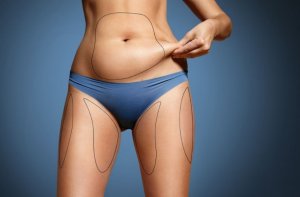 Woman pinching stomach