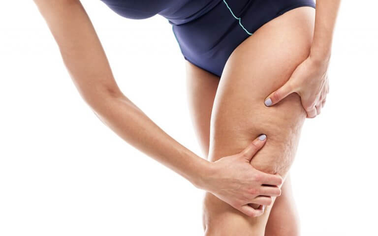 Top Workouts and Exercises to Eliminate Cellulite