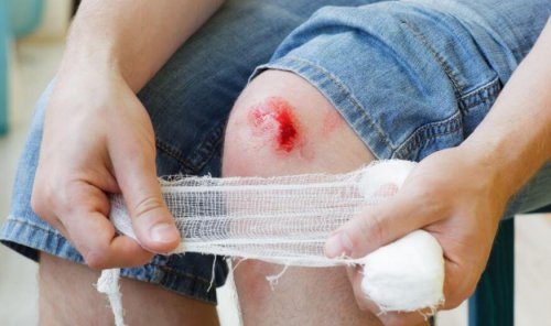 If you have protein deficiency, wounds may take longer to heal injuries and scarring