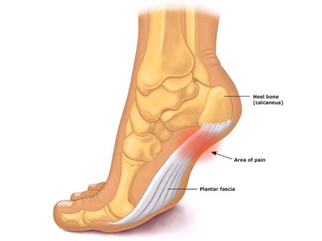 The plantar fascia is the tissue that covers the lower part of the foot.