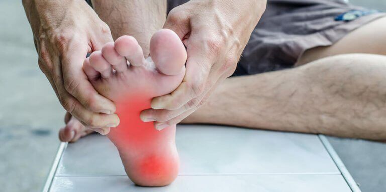 A man with symptoms of plantar fasciitis 