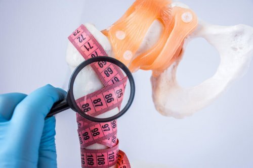 Osteoporosis and bone density.