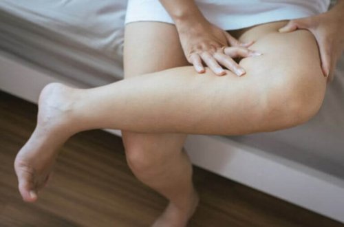 Photo of swollen legs supporting the topic in the article.