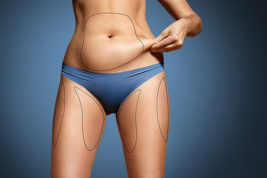 stubborn fat deposits factors