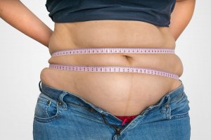 The History of Obesity: A Short Summary