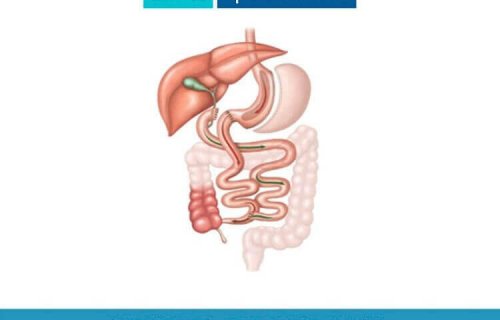 These surgeries reduce the amount of food that a person can absorb.