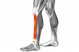A diagram highlighting shin splints.
