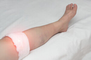 What Are the Symptoms of Knee Bursitis?