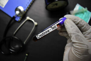 Is Creatinine Harmful To Your Health?