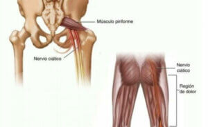 The piriformis muscle.