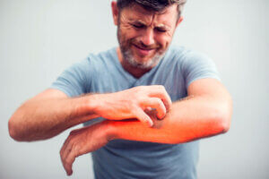 Exercise-Induced Anaphylaxis: Symptoms and Treatment