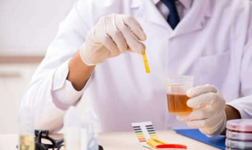 A medical professional analyzing urine.