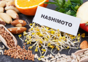 What's The Hashimoto Diet?